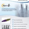 ToeMATE Tech Guide