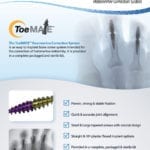 ToeMATE Tech Guide