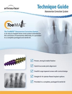ToeMATE Tech Guide