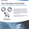 OVO/Glenoid Case Studies by Dr. Cascio