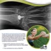WristMotion Tech Guide