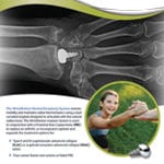 WristMotion Tech Guide