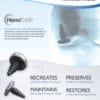 Femoral Condyle Tech Guide