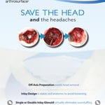 Glenoid Sell Sheet