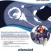 Glenojet Tech Guide