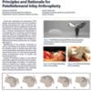 PF Inlay Arthroplasty Clinical Monograph