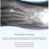 HemiCAP Toe Tech Guide