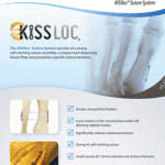 KISSloc Tech Guide