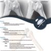 OVO, OVOMotion & Inlay Glenoid Tech Guide