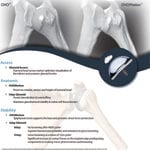 OVO, OVOMotion & Inlay Glenoid Tech Guide
