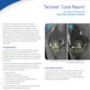 Tactoset Case Report - Dr. Tierney