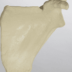 Glenoid Sawbones