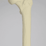 Hip Sawbone