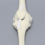 Full Knee Sawbone