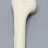 Shoulder Sawbones