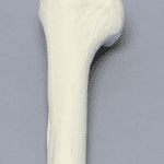 Shoulder Sawbones
