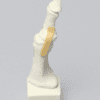 Toe Sawbones