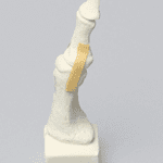 Toe Sawbones